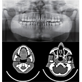 Dental Radiography Head Phantom 2